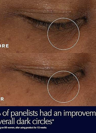 Estée Lauder Advanced Night Repair Eye Supercharged Gel-Cream Synchronized Multi-Recovery | Eye Cream for Dark Circles - MimiStylez