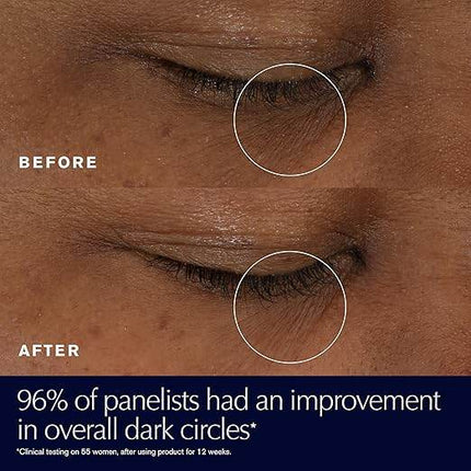Estée Lauder Advanced Night Repair Eye Supercharged Gel-Cream Synchronized Multi-Recovery | Eye Cream for Dark Circles - MimiStylez